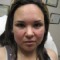 IPL-Before