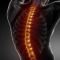 Backbone  problems - medical posterior view