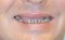 "Mr L"  Before