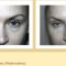  Eyelid Surgery (Blepharoplasty) Before and After Pictures