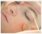 Professional Hair Removal